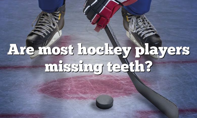 Are most hockey players missing teeth?