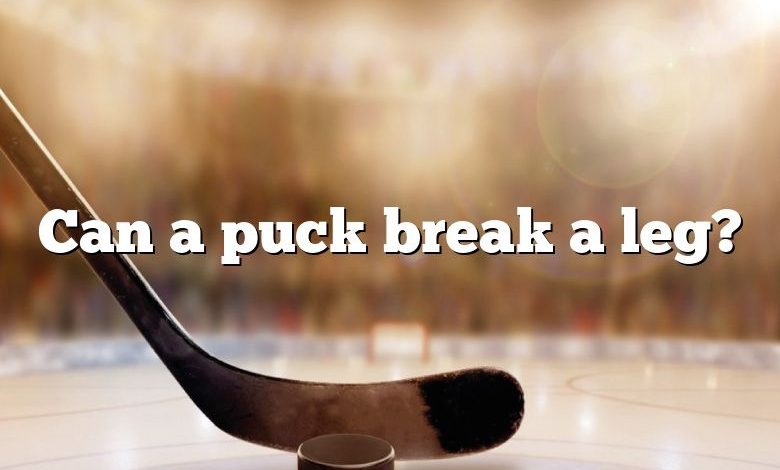 Can a puck break a leg?