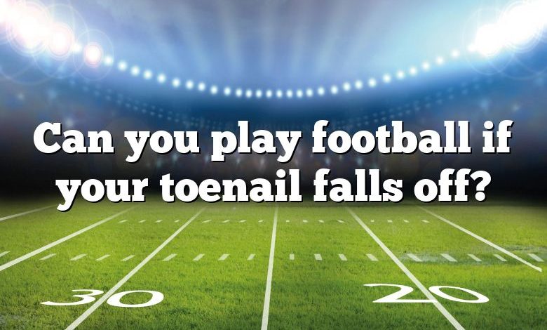 Can you play football if your toenail falls off?