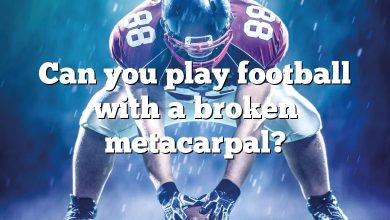 Can you play football with a broken metacarpal?