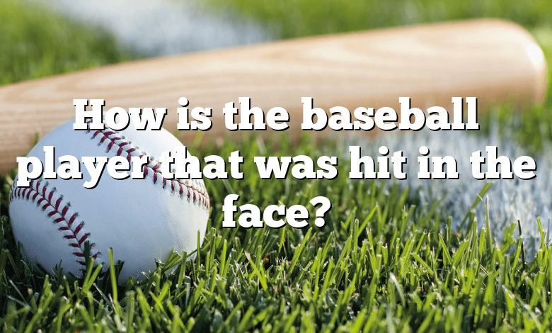 How is the baseball player that was hit in the face?