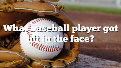 What baseball player got hit in the face?
